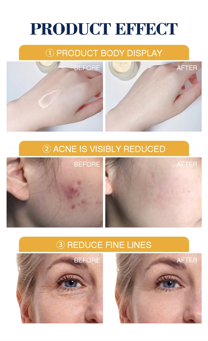 Custom Logo Face Cream Best Selling Black Skin Care Anti Acne Brightening Moisturizing Turmeric Face Cream